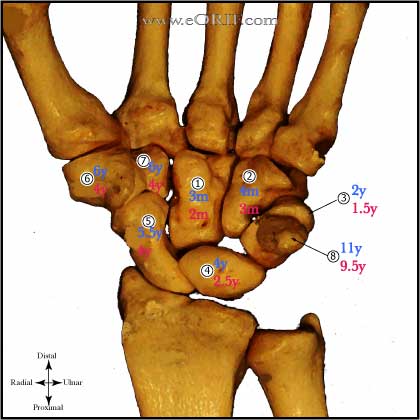 carpal ossification