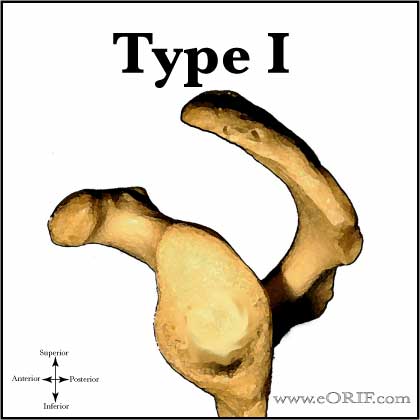 Type 1 acromioin