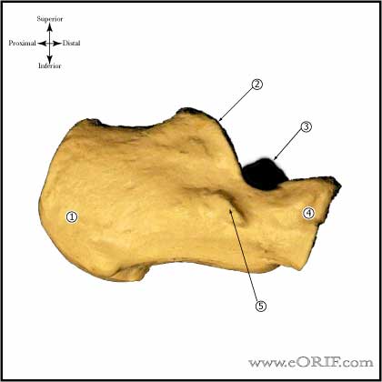 Calcaneous Lateral View