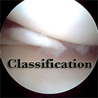 meniscal tear classifcation