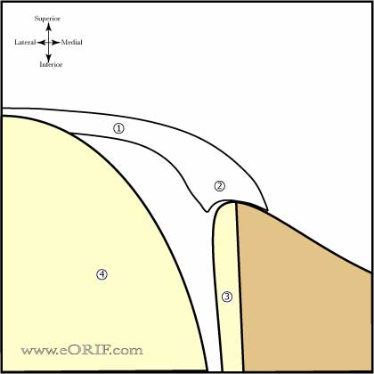 Type 2 Biceps Labral Complex