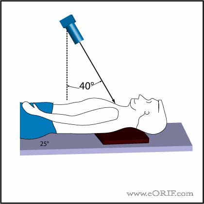 Serendipity View Shoulder Xray Serendipity View Shoulder Xray