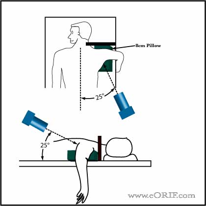 West Point Axillary View Shoulder Xray West Point Axillary View Shoulder Xray