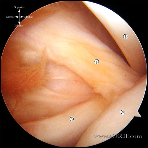 glenohumeral ligaments picture