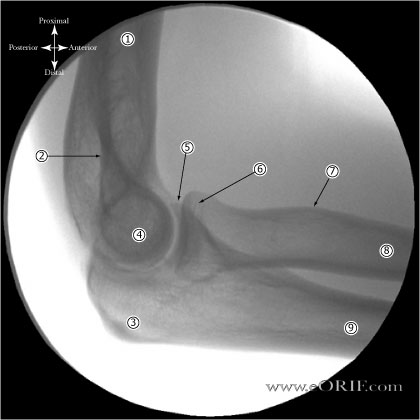 Lateral Elbow Xray