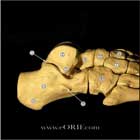 Talus anatomy image Talus anatomy image lateral view